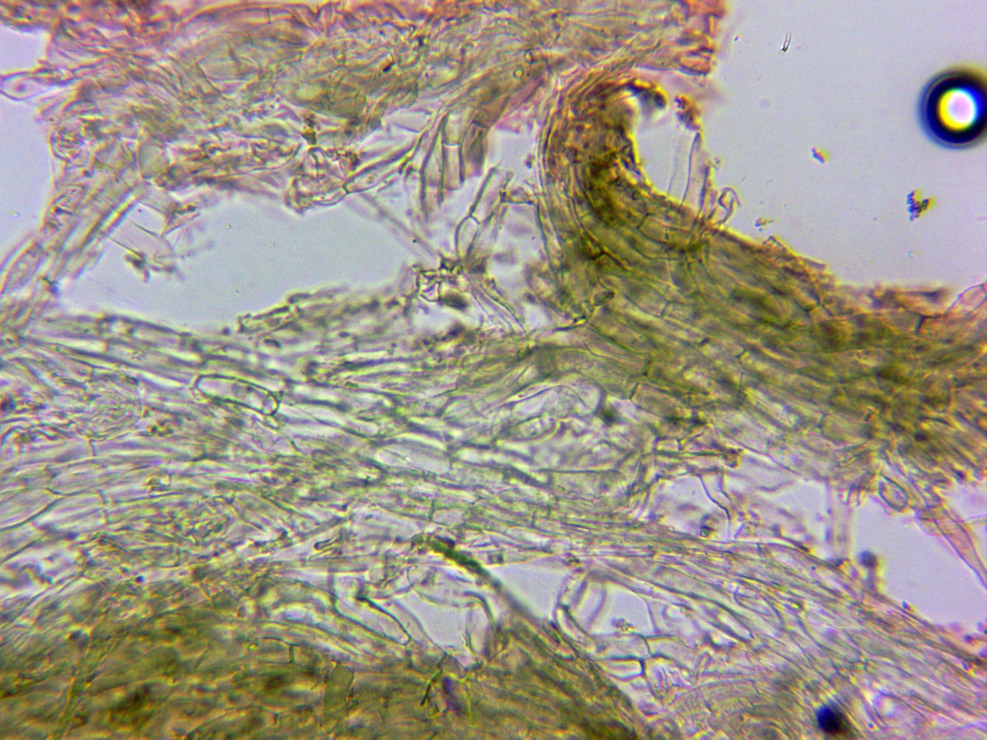 Microscopía de Tricholoma arvernense - 10 - Cutícula x 400